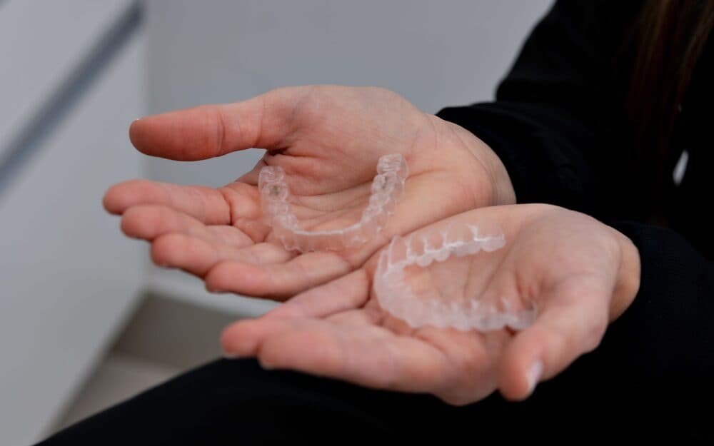 A clear Invisalign aligner held between gloved fingers