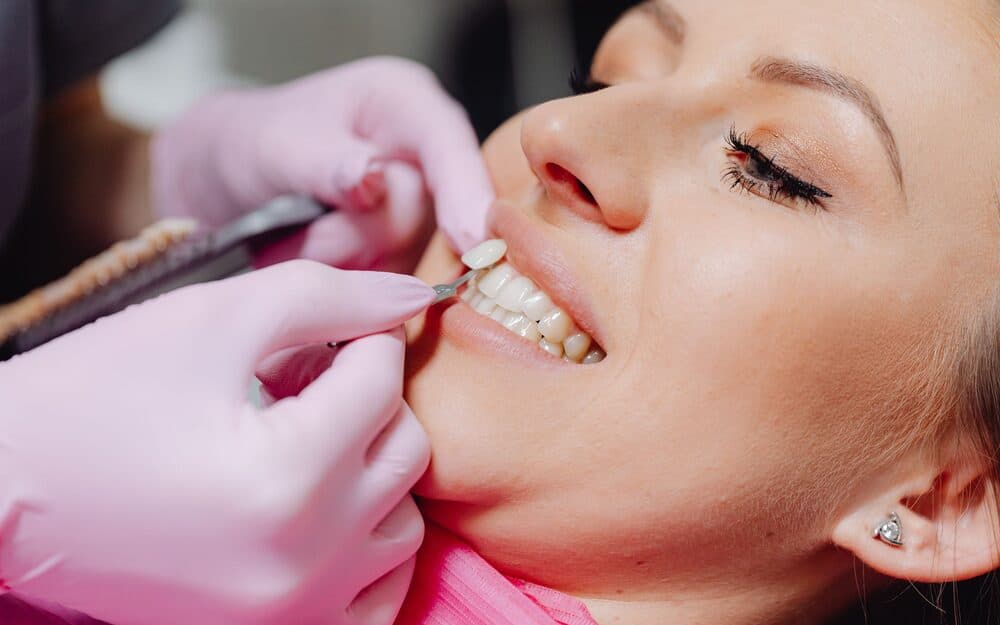 A close-up of a patient's smile after cosmetic dental work